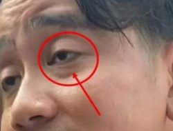 Sebut Materi Pandji Menuai Kritik dr. Tompi