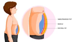 Tips Mengecilkan Perut Buncit