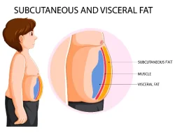 Tips Mengecilkan Perut Buncit